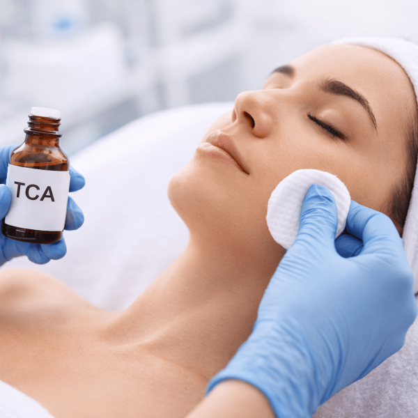 BioRePeel – peeling chemiczny TCA: działanie, efekty i wskazania
