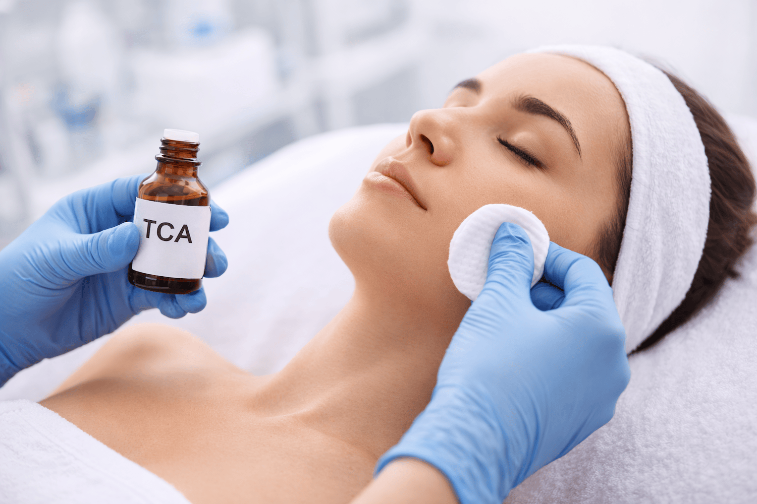 BioRePeel – peeling chemiczny TCA: działanie, efekty i wskazania